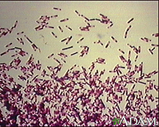 Photograph of the bacterium Clostridium difficile