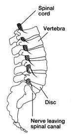 Image of lower back vertebra, discs, Spinal cord and nerve leaving the Spinal canal.