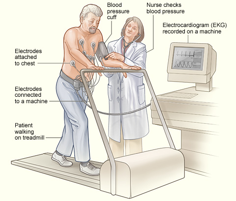Illustration showing a patient having a stress test.