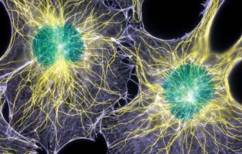 In these cells, actin filaments appear light purple, microtubules yellow, and nuclei greenish blue. This image, which has been digitally colored, won first place in the 2003 Nikon Small World Competition.