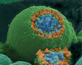 A scanning electron microscope picture of a nerve ending. It has been broken open to reveal vesicles (orange and blue) containing chemicals used to pass messages in the nervous system.