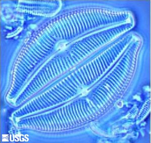 Diatom image of the species Cymbella tumida.