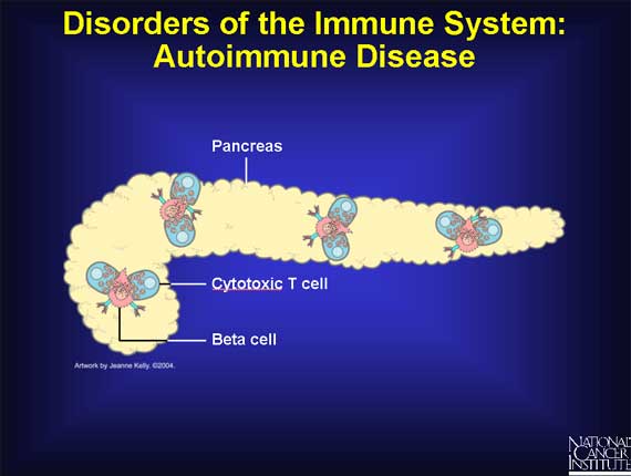 Disorders of the Immune System: Autoimmune Disease