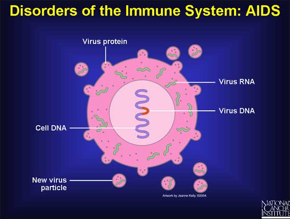Disorders of the Immune System: AIDS