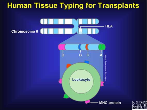Human Tissue Typing for Transplants