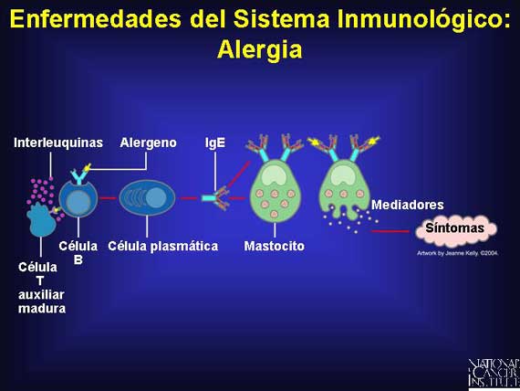 Enfermedades del Sistema Inmunológico: Alergia