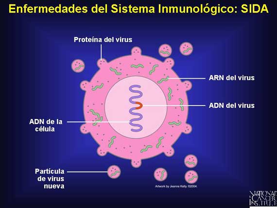 Enfermedades del Sistema Inmunológico: SIDA