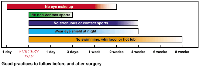 Good practices to follow before and after surgery. From 1 day before to 2 weeks after, no eye makeup. For 3 days after, no non-contact sports. 4 weeks after, no strenuous or contact sports and wear eye shield at night. 8 weeks after, no swimming, whirlpool or hot tub.