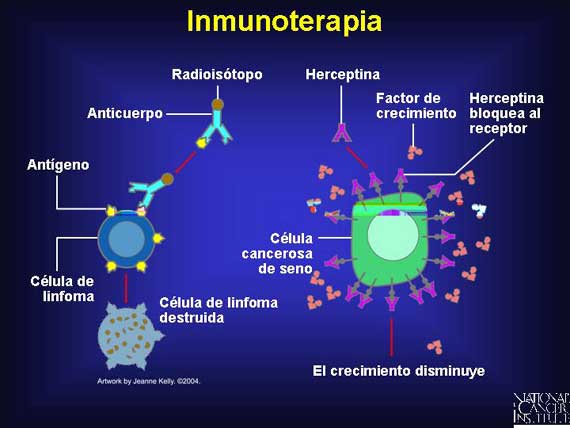 Inmunoterapia