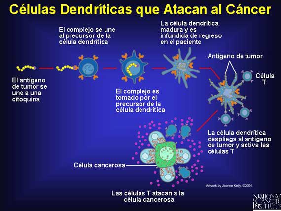Células Dendríticas que Atacan al Cáncer