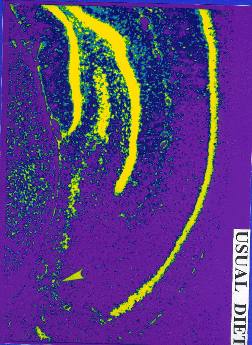 Diagram-Diet and Neuronal Vulnerability