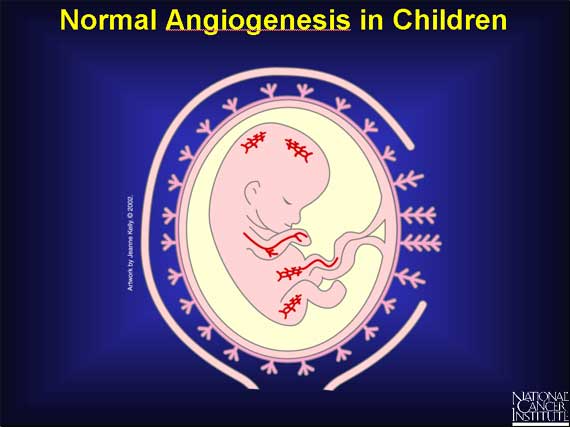 Normal Angiogenesis in Children