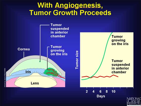 With Angiogenesis, Tumor Growth Proceeds