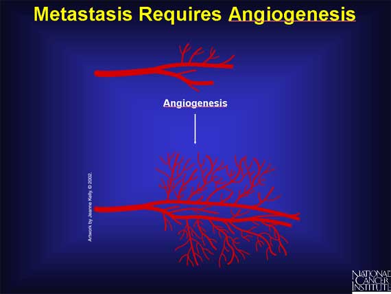 Metastasis Requires Angiogenesis