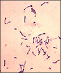 This photomicrograph depicted a number of Gram-positive Corynebacterium diphtheriae bacteria, which had been stained using the methylene blue technique. The specimen was taken from a Pai’s slant culture.