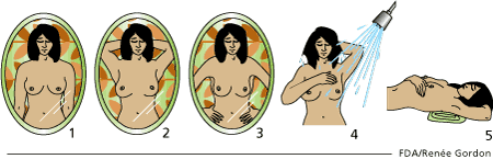 image of how to examine your breasts