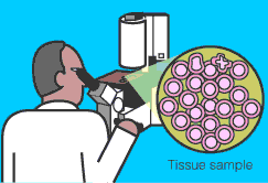 The pathologist uses a microscope to look at tissue.