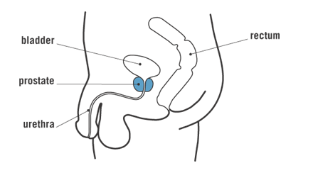 Diagram of the Prostate, Bladder, Rectum, and Urethra