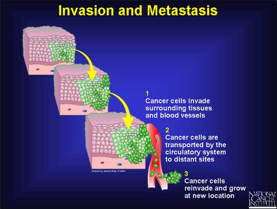 Invasion and Metastasis