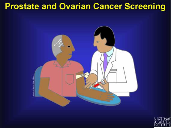 Prostate and Ovarian Cancer Screening