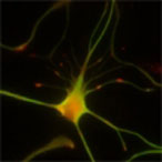 cassiani neuron