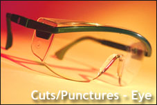 Cuts/Punctures - Eye - Copyright WARNING: Not all materials on this Web site were created by the federal government. Some content — including both images and text — may be the copyrighted property of others and used by the DOL under a license. Such content generally is accompanied by a copyright notice. It is your responsibility to obtain any necessary permission from the owner's of such material prior to making use of it. You may contact the DOL for details on specific content, but we cannot guarantee the copyright status of such items. Please consult the U.S. Copyright Office at the Library of Congress — http://www.copyright.gov — to search for copyrighted materials.