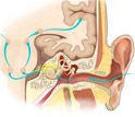 This illustration shows how soundwaves interact with the human cochlea.