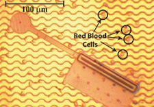 A photograph of a typical nanosoccer robot compared in size to red blood cells. About 200 of these robots could stretch in a line across the top of a plain M&M candy. Click here for larger image.