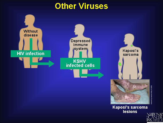 Other Viruses
