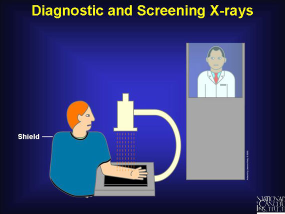 Diagnostic and Screening X-rays