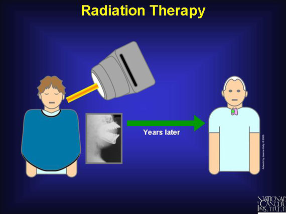 Radiation Therapy