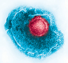 The varicella-zoster virus, colorized in red - Click to enlarge in new window.