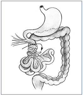 In volvulus, a portion of the intestine twists around itself