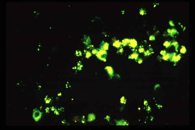 Indirect immunofluorescense assay of Ehrlichia chaffeensis in DH82 cells, magnification 400 times