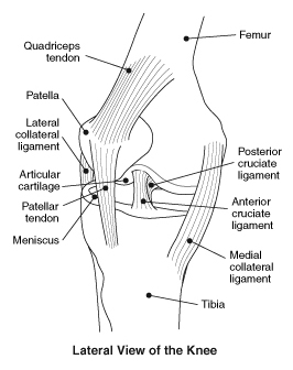 Illustration depicting a lateral view of the knee, showing the location of: Quadriceps tendon; Patella; Lateral collateral ligament; articular cartilage; Patellar tendon; Meniscus; Tibia; Medial collateral ligament; Anterior cruciate ligament; Posterior cruciate ligament; and Femur.