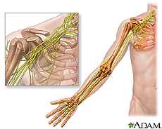 Illustration of the shoulder and arm featuring the brachial plexus
