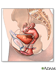 Ilustración del sistema urinario y reproductor femenino