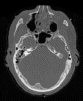 Specimen from the Visible Human Male - Head subset