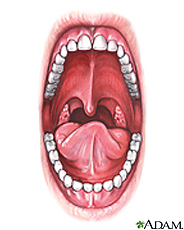 Illustration of oral anatomy