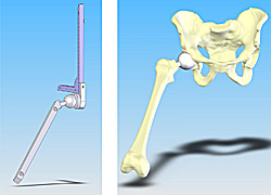 illustration of prototype hip replacement and illustration of hip joint