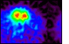 Brain scan image