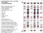 IEF Calibrated Gel image