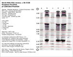 IEF Calibrated Gel image