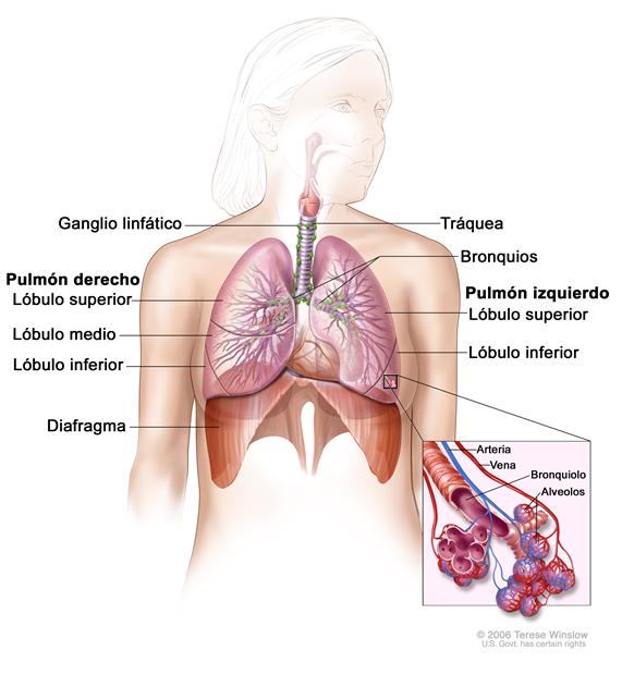Anatomía respiratoria; el dibujo muestra el pulmón derecho con los lóbulos superiores, medios e inferiores; el pulmón izquierdo con los lóbulos superiores e inferiores; y la tráquea, los bronquios, los ganglios linfáticos y el diafragma.  El recuadro muestra los bronquiolos, los alvéolos, la arteria y la vena.