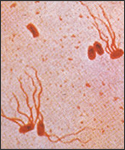 A photomicrograph of Salmonella typhosus bacteria using a Flagellar stain technique.  Salmonella typhosus, also known as Eberthella typhi and Bacillus typhosus, is the cause of Typhoid fever.