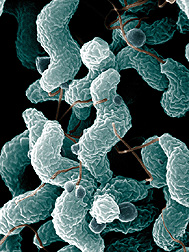 Scanning electron microscope image of Campylobacter jejuni cells and related structures. Link to photo information
