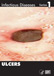 Ulcers