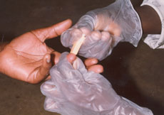 Photo of a clinician taking a blood sample for HIV testing.
