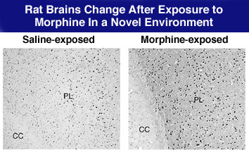 Rat Brains Injected With Saline or Morphine