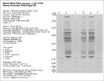 Phast Plate Gel image